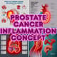 Prostate Cancer Inflammation Concept - Cinematic Medical Stock Video for Educational and Scientific Use 4