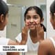Teen Girl Squeezing Acne - Candid Lifestyle Stock Video for Family and Wellness Content Creators 5