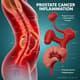 Prostate Cancer Inflammation Concept - Cinematic Medical Stock Video for Educational and Scientific Use 1