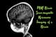 MRI Brain Scan Imaging - Cinematic Medical Stock Video for Educational and Scientific Use 1