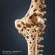 Bone Density Loss - Humerus Deterioration Demo - Cinematic Medical Visual Effects for Health Education and Film Projects 4