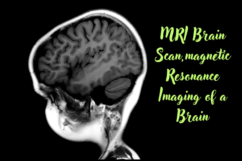 MRI Brain Scan Imaging - Cinematic Medical Stock Video for Educational and Scientific Use